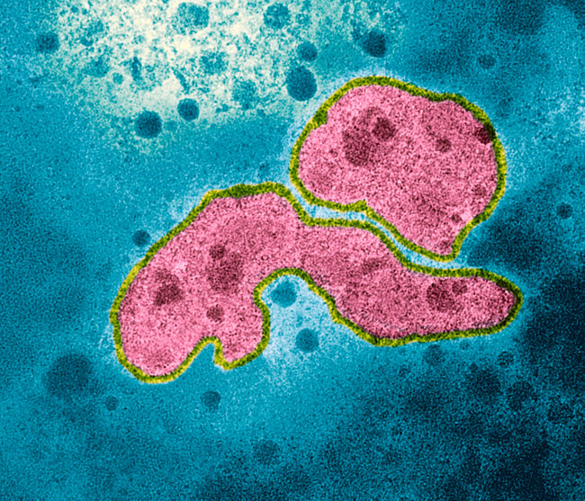 A(H5N1) virus
