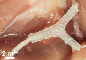 3D-printed nerve regeneration pathway