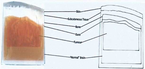 3D tissue model