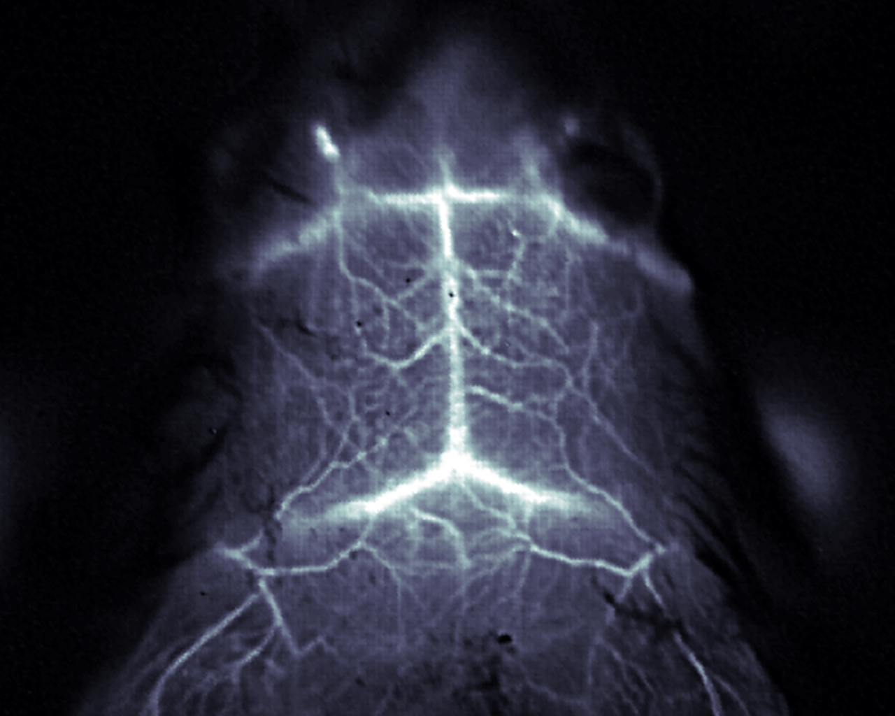 6- image of brain