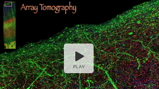 array-tomography