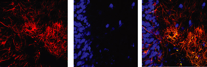 Astrocytes & neurons