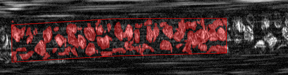 Blood Flow Imaging 2 Blood Flow Imaging 2