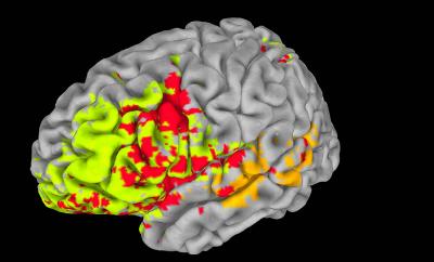 Brain Structures