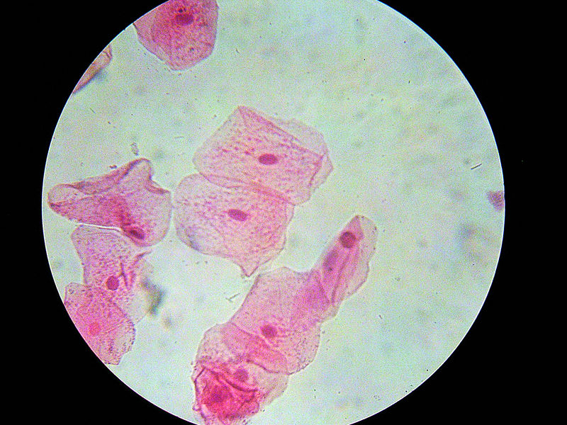 Cheekcells_stained