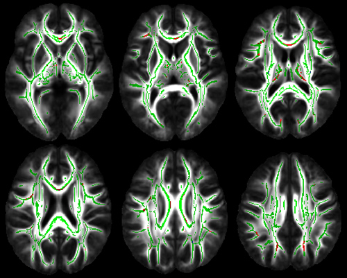 Cognitive activity