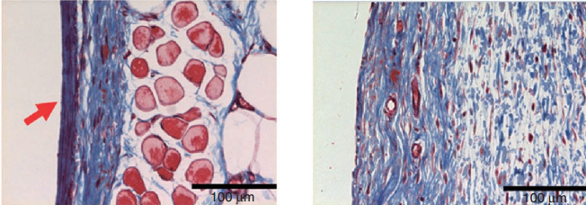 Collagen and blood vessel formation