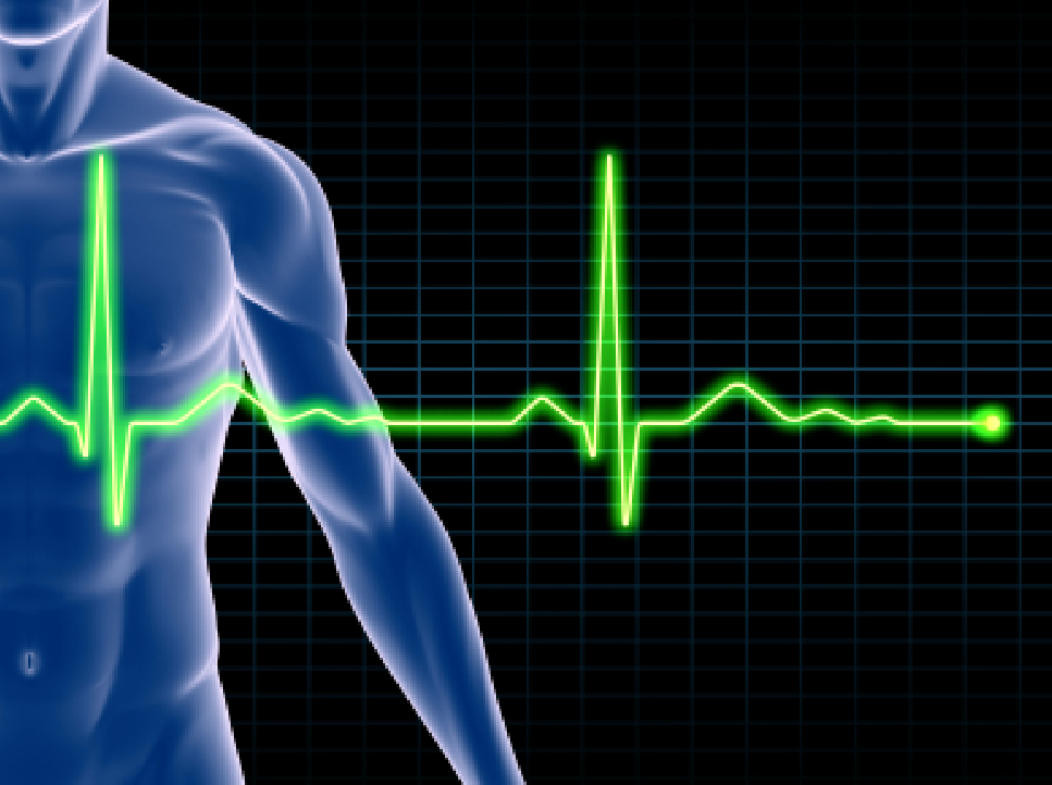 EKG