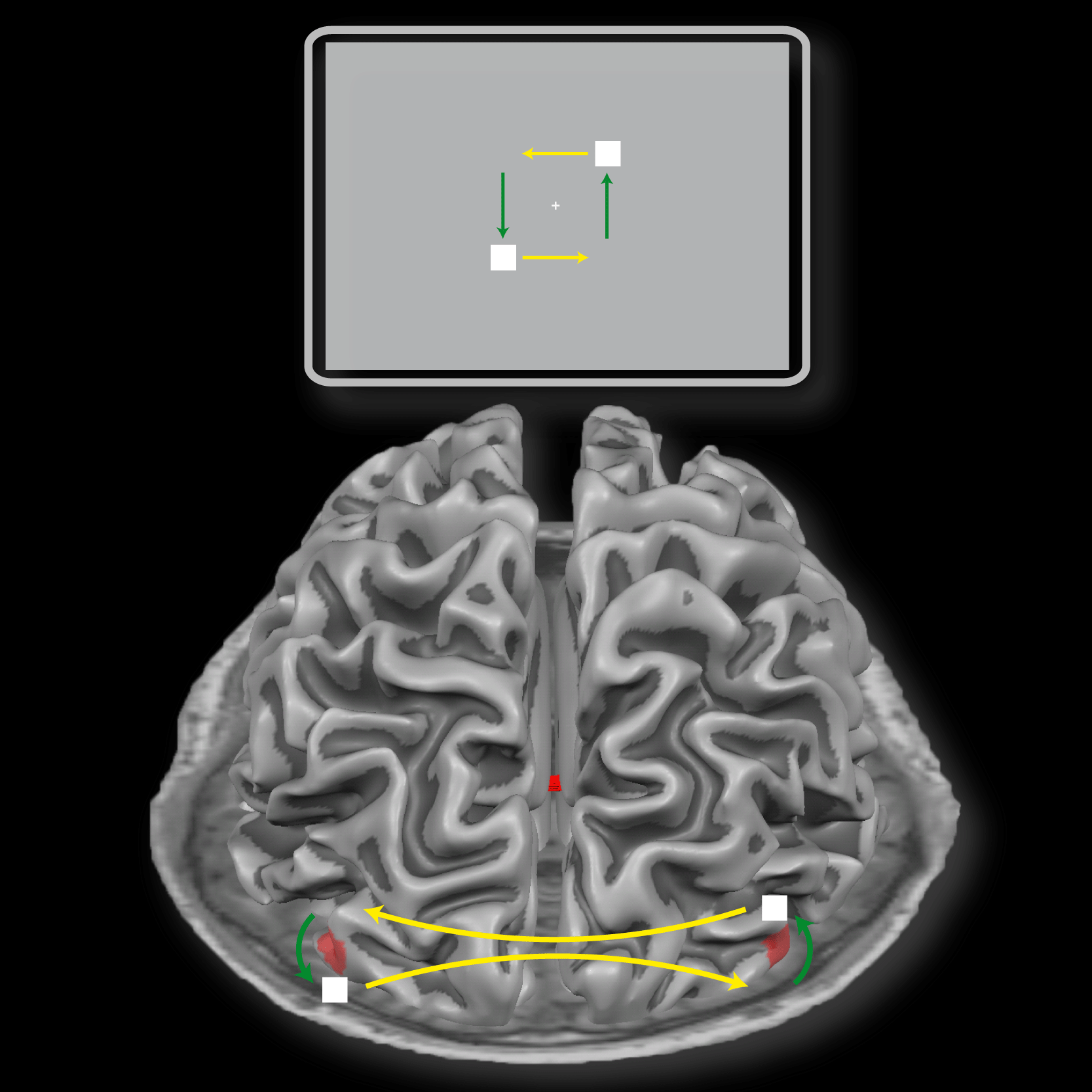 Interhemispheric connections shape subjective experience of bistable motion