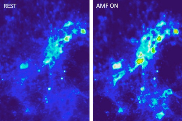 MIT-Brain-Particles-01