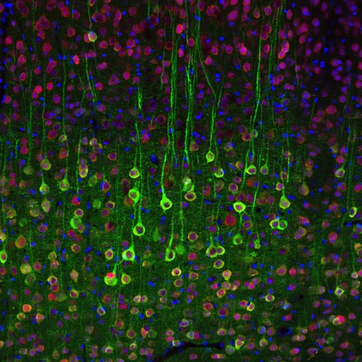 Pyramidal cells in the brain
