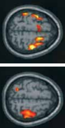 MRI-scans---mercury