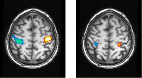 Motor Cortex