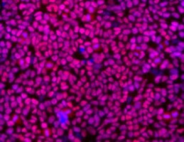 Neural-Precursor Neural Precursor