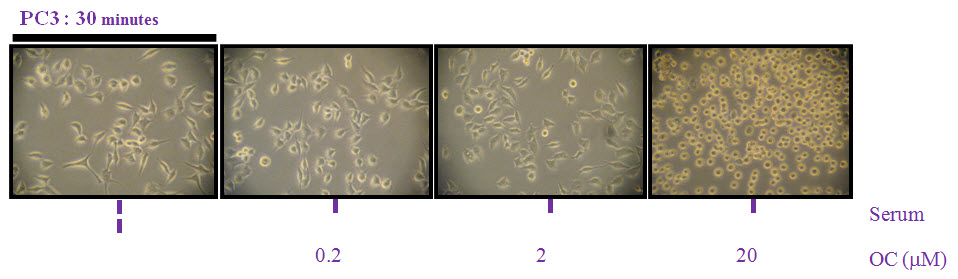 PC3 cancer cells
