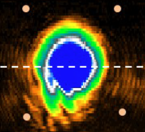 Polariton_condensate_wavepacket