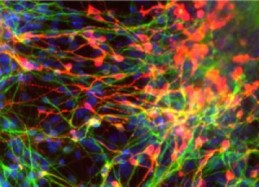Stained-Neuron Stained Neuron