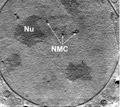 X-ray nanotomography
