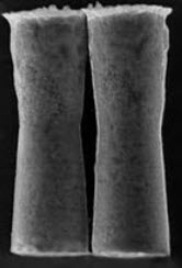 Zinc stomach micromotors