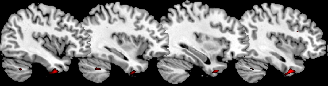 anterior temporal cortex_slices anterior temporal cortex_slices