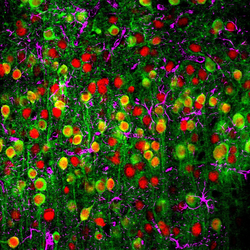 auditory cortex_pr