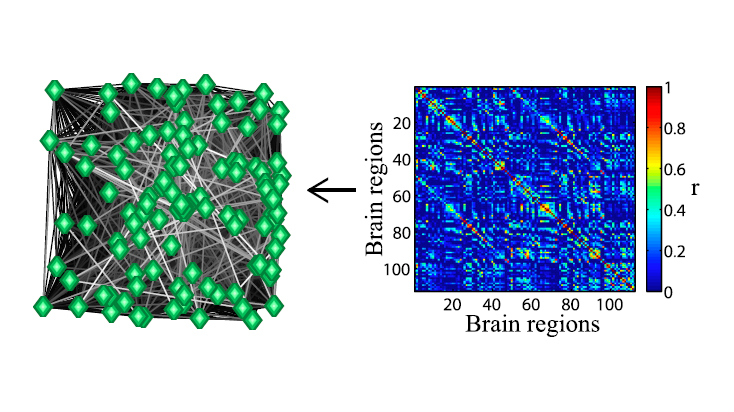 brain_network