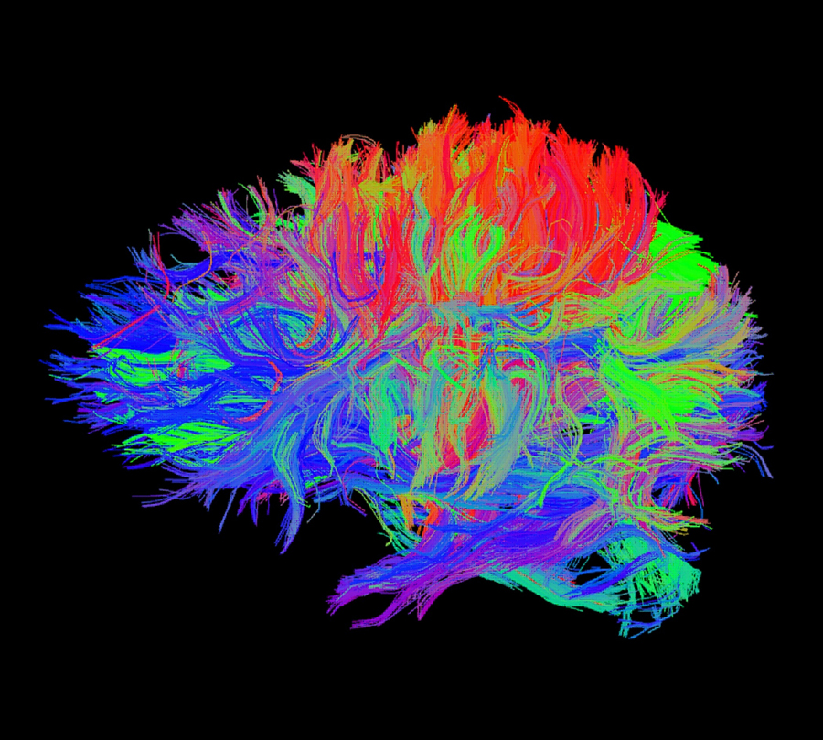 brainfibersimage brainfibersimage