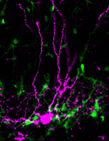 brains stem cells