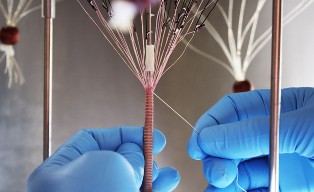 cytograft1 cytograft1