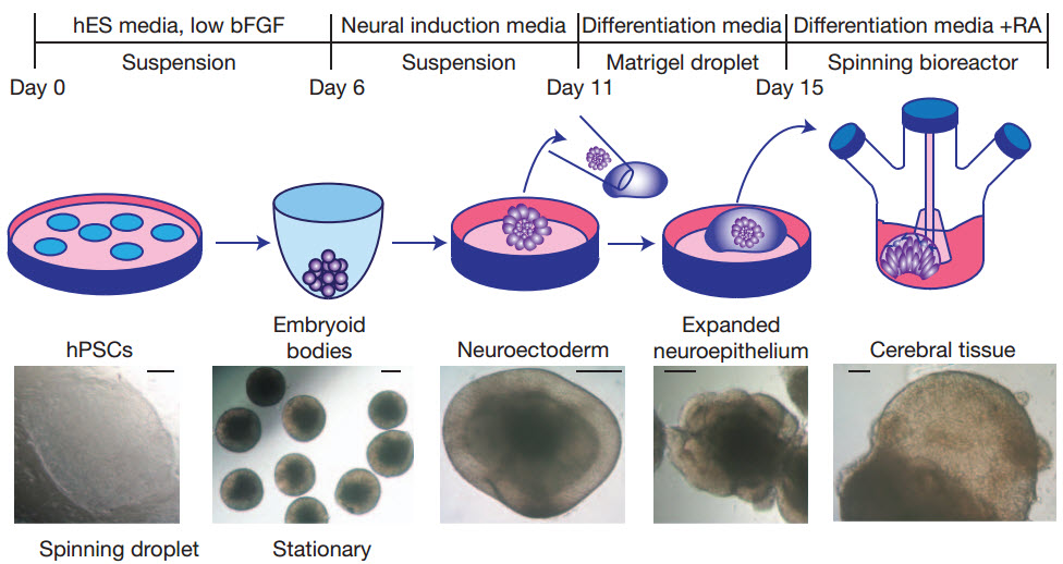 growing a brain