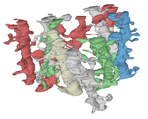 hippocampal-dendrites1