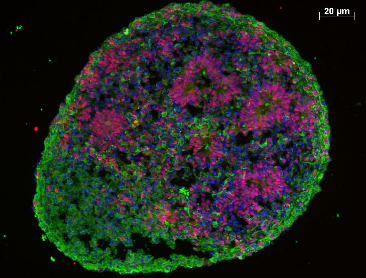 human brain organoid