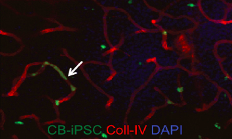 iPSC-derived_vascular_stem_cells