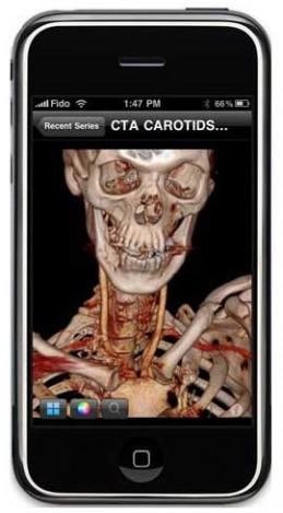 iPhone-Stroke iPhone Stroke