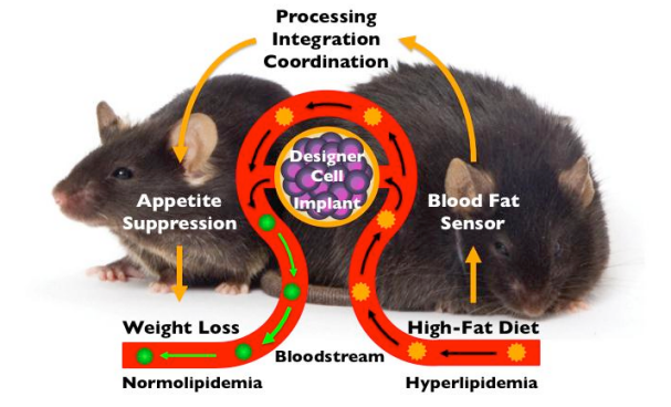 implantable_slimming_aid