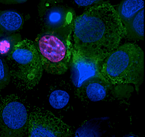 insulin_producing_cells
