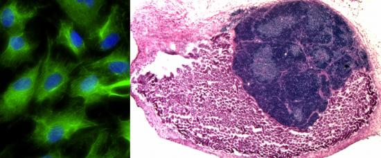 itec-transplanted