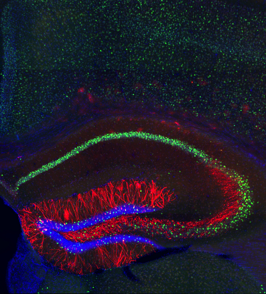 memory_traces_hippocampus memory_traces_hippocampus