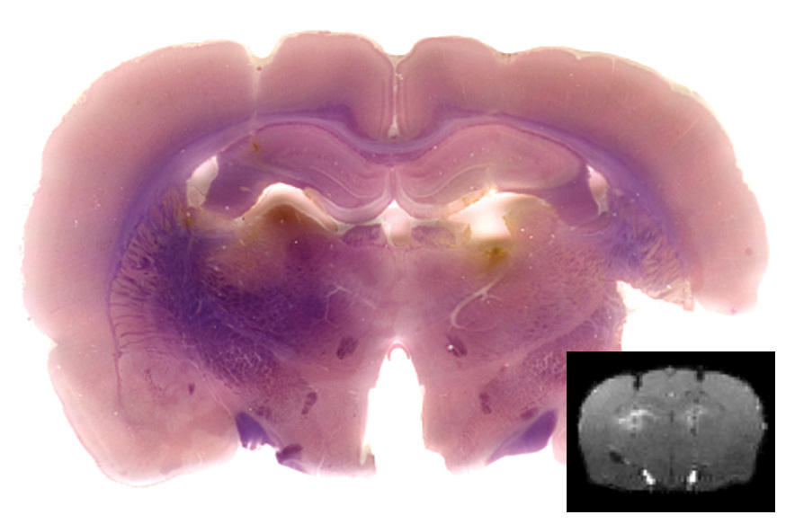 mri_contrast_protein mri_contrast_protein