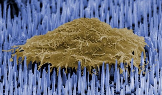 nanoneedles