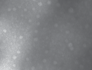 nanoparticles with DOX