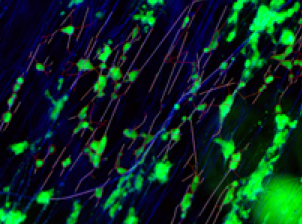 neuronal cultures