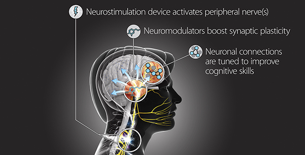 neurostimulation