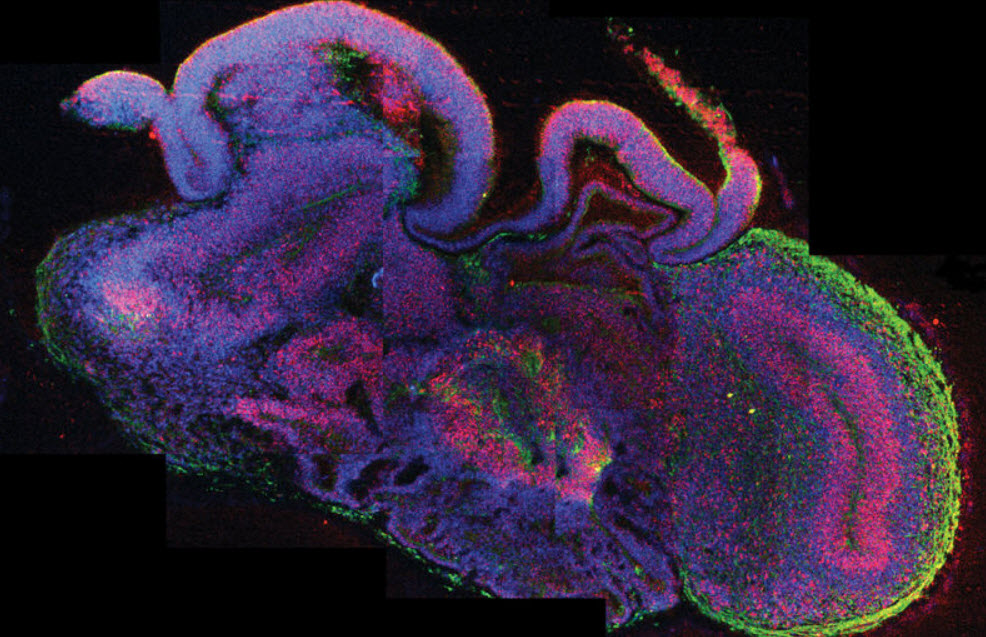 organoid