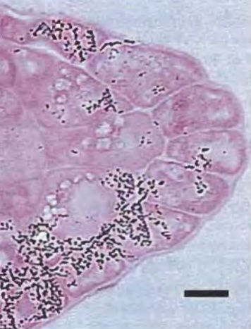 root tip