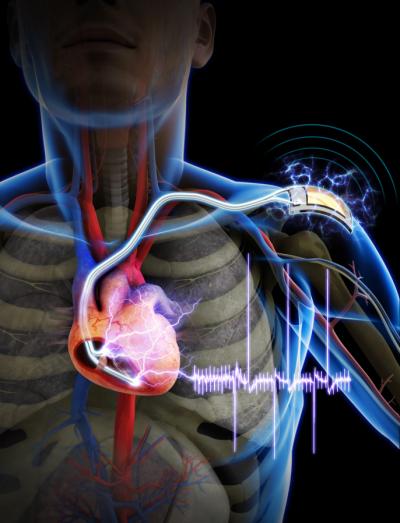 self-powered-cardiac-pacemaker
