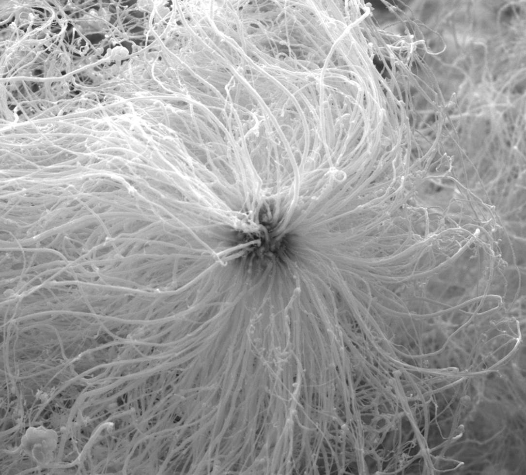 urchin_nanoparticle