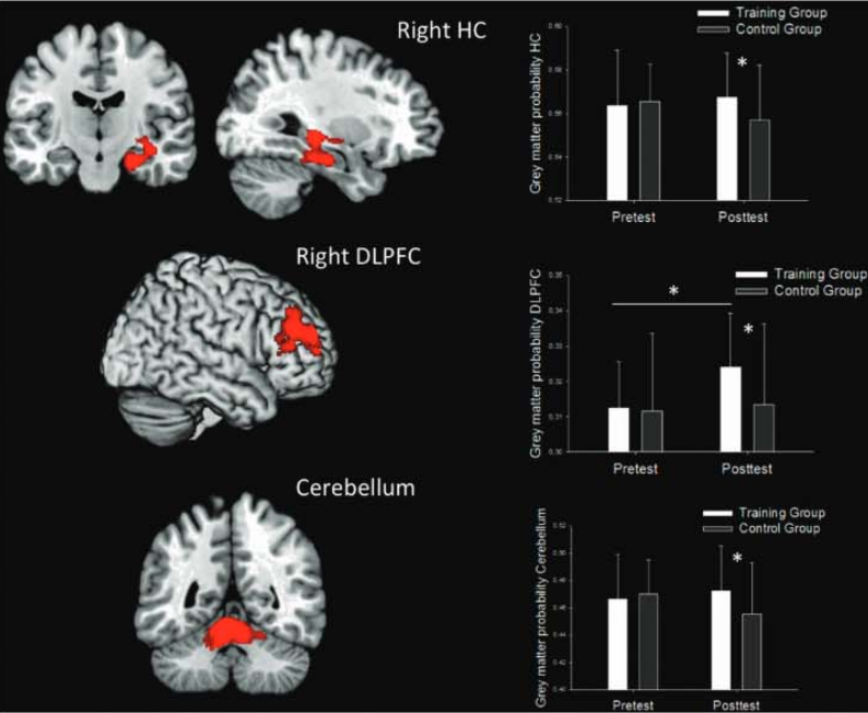 Video games good for brain deals