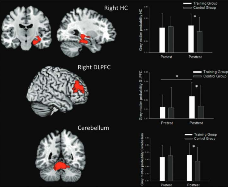 Video game playing found beneficial for the brain « the Kurzweil Library +  collections