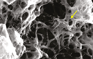 Carbon Nanotubes